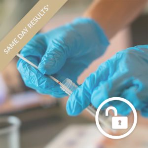 Self Administered Fit To Fly Coronavirus Test The London General Practice